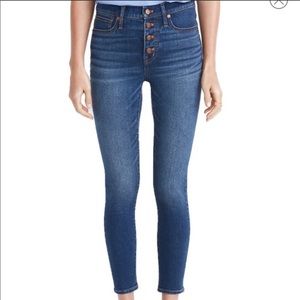 Madewell Button Front Crop Skinny Jeans 9”